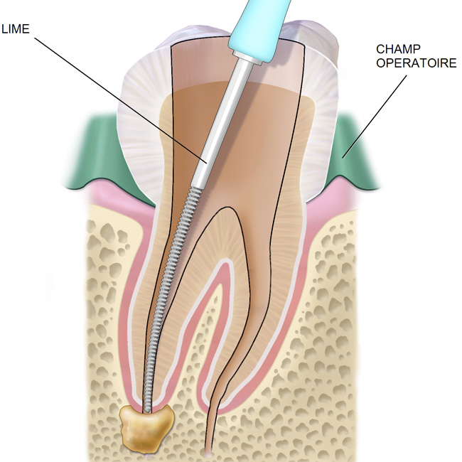 Endodontie