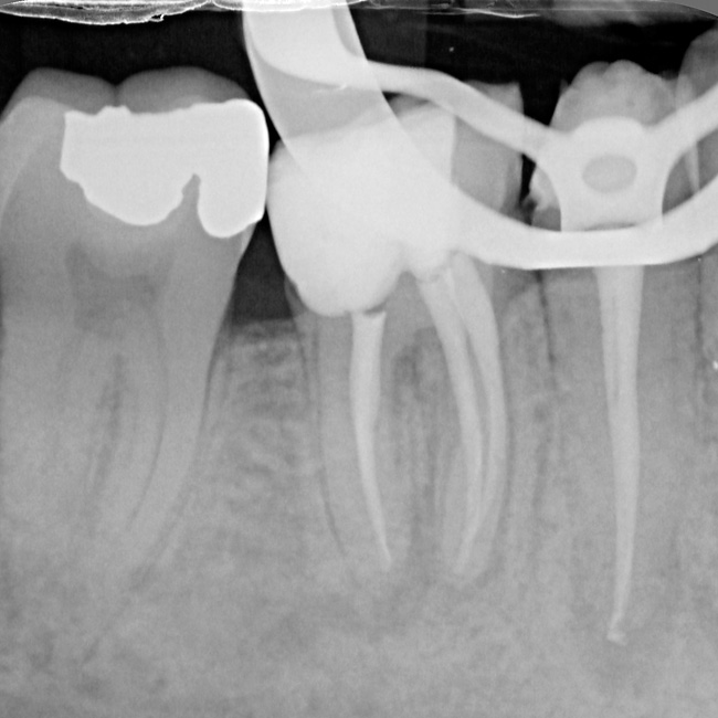 Endodontie